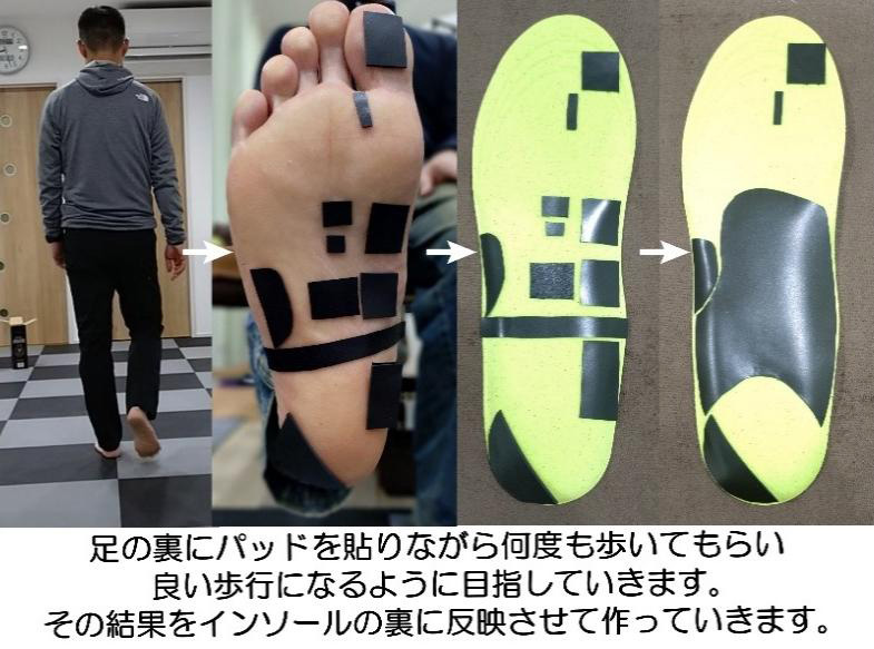 足の裏にパッドを貼りながら何度も歩いてもらい良い歩行になるように目指していきます。その結果をインソールの裏に反映させて作っていきます。インソールにパッドを貼る経過の画像
